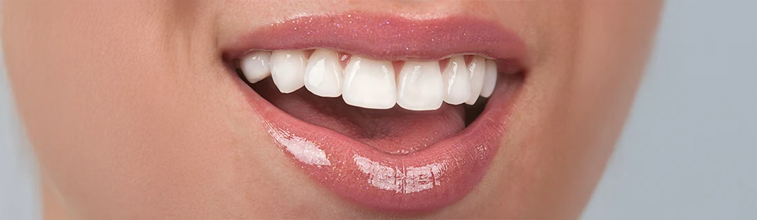A close-up shows a person's mouth with glossy pink lips slightly parted, revealing bright, white upper teeth.