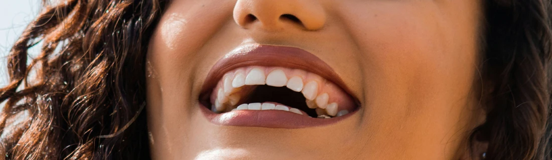 Dentist Canoga Park CA Teeth Whitening Focused A close-up of a smiling mouth with white teeth and dark curly hair.